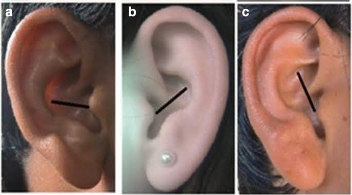 कर्ण एवं नासिका का क्या महत्त्व  है बॉडी लैंग्वेज और आपके जीवन में इसका क्या महत्व&nbsp;है